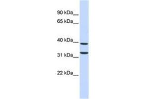 Image no. 1 for anti-Zinc Finger Protein 177 (ZNF177) (C-Term) antibody (ABIN6742763) (ZNF177 anticorps  (C-Term))