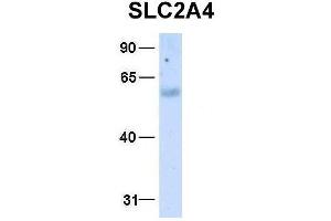 Host:  Rabbit  Target Name:  SLC2A4  Sample Type:  Human Fetal Liver  Antibody Dilution:  1.