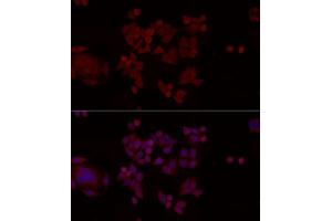 Immunofluorescence analysis of HeLa cells using ANP32A antibody.