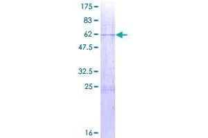Image no. 1 for ST6 (Alpha-N-Acetyl-Neuraminyl-2,3-beta-Galactosyl-1,3)-N-Acetylgalactosaminide alpha-2,6-Sialyltransferase 4 (ST6GALNAC4) (AA 1-302) protein (GST tag) (ABIN1321510)