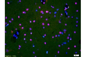Formalin-fixed and paraffin-embedded rat brain labeled with Anti-HDAC3/HD3 Polyclonal Antibody, Unconjugated (ABIN734903) 1:200, overnight at 4 °C, The secondary antibody was Goat Anti-Rabbit IgG, Cy3 conjugated used at 1:200 dilution for 40 minutes at 37 °C and DAPI staining.