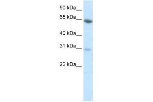 WB Suggested Anti-ZNF195 Antibody Titration:  0. (ZNF195 anticorps  (N-Term))