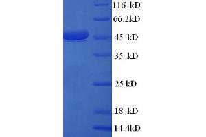 VP6 (AA 1-397), (full length) protein (His tag)