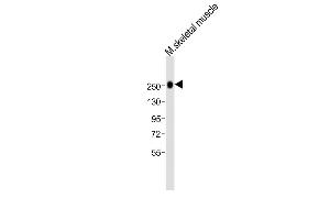 Anti-MYH1 Antibody (N-term)at 1:2000 dilution + mouse skeletal muscle lysates Lysates/proteins at 20 μg per lane. (MYH1 anticorps  (N-Term))