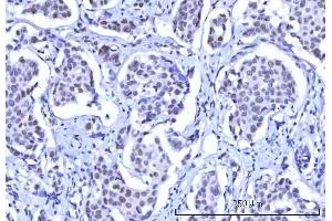IHC analysis of RBM15B using anti-RBM15B antibody (ABIN7600219). (RBM15B anticorps  (AA 164-890))