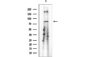 anti-Opioid Receptor, mu 1 (OPRM1) (C-Term) antibody
