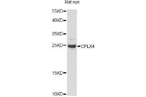 Western blot analysis of extracts of rat eye, using CPLX4 antibody (ABIN6291614) at 1:3000 dilution.