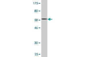Western Blot detection against Immunogen (62.