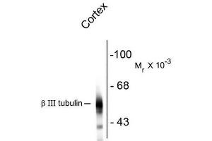 Western Blotting (WB) image for anti-Tubulin, beta 3 (TUBB3) antibody (ABIN371847) (TUBB3 anticorps)