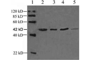 Lane 1: EasyWestern Protein Standard   Lane 2: Rabbit muscular tissue lysateLane 3: Fish tissue lysateLane 4: Hela cell lysateLane 5: Rat brain lysate Primary antibody: 1 µg/mL Rabbit Anti-alpha-Actin-1 Polyclonal Antibody (ABIN398560) The result was developed with One-Step WesternTM Complete Kit (Rabbit) (ABIN491509) (Actin anticorps)