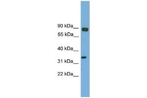 WB Suggested Anti-Ehf Antibody Titration:  0. (EHF anticorps  (Middle Region))