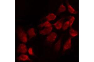 ABIN6274666 staining Hela by IF/ICC. (FGF18 anticorps  (Internal Region))