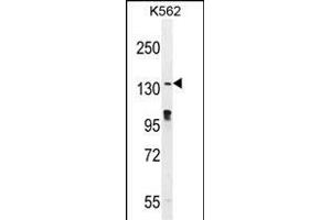 OVOS Antibody (N-term) (ABIN655570 and ABIN2845070) western blot analysis in K562 cell line lysates (35 μg/lane). (OVOS1 (AA 99-128), (N-Term) anticorps)