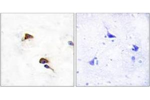 Immunohistochemistry analysis of paraffin-embedded human brain tissue, using PPIF Antibody. (PPIF anticorps  (AA 86-135))