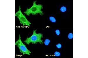 (ABIN184581) Immunofluorescence analysis of paraformaldehyde fixed HepG2 cells, permeabilized with 0. (ALDH1A1 anticorps  (C-Term))