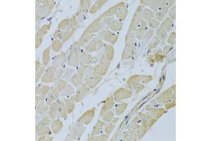 Immunohistochemistry of paraffin-embedded rat heart using C Antibody (ABIN3021738, ABIN3021739, ABIN3021740 and ABIN6215697) at dilution of 1:200 (40x lens). (CA3 anticorps  (AA 1-260))