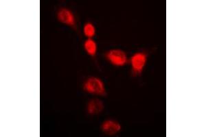 Immunofluorescent analysis of hnRNP A2/B1 staining in HeLa cells. (HNRNPA2B1 anticorps  (N-Term))