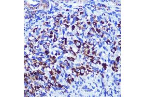 Immunohistochemistry of paraffin-embedded rat ovary using PALLD Rabbit pAb  at dilution of 1:100 (40x lens).