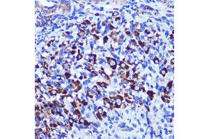 Immunohistochemistry of paraffin-embedded rat ovary using PALLD Rabbit pAb  at dilution of 1:100 (40x lens). (PALLD anticorps  (AA 383-672))
