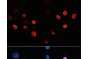 Immunofluorescence analysis of HeLa cells using HDAC3 Polyclonal Antibody at dilution of 1:100 (40x lens). (HDAC3 anticorps)
