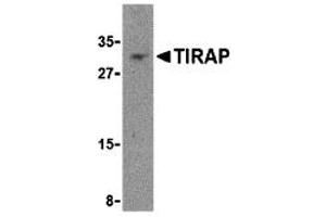 Western Blotting (WB) image for anti-Toll-Interleukin 1 Receptor (TIR) Domain Containing Adaptor Protein (TIRAP) (Middle Region) antibody (ABIN1031126) (TIRAP anticorps  (Middle Region))