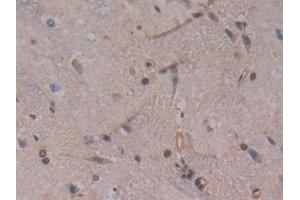 Detection of GSTt2 in Rat Spinal cord Tissue using Polyclonal Antibody to Glutathione S Transferase Theta 2 (GSTt2)