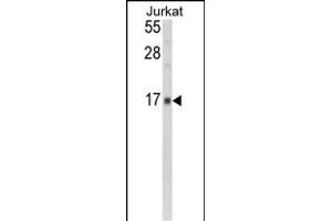 Western blot analysis of GMFG Antibody (N-term) (ABIN392351 and ABIN2841990) in Jurkat cell line lysates (35 μg/lane). (GMFG anticorps  (N-Term))