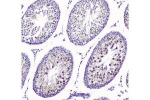 IHC analysis of SMC6L1 using anti-SMC6L1 antibody (ABIN5693133). (SMC6 anticorps  (AA 205-443))