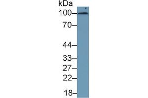 Detection of CD276 in Human Serum using Monoclonal Antibody to Cluster Of Differentiation 276 (CD276) (CD276 anticorps  (AA 47-219))