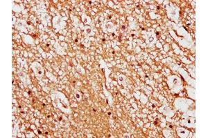 IHC image of ABIN7158375 diluted at 1:500 and staining in paraffin-embedded human brain tissue performed on a Leica BondTM system.