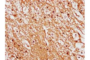 IHC image of ABIN7158375 diluted at 1:500 and staining in paraffin-embedded human brain tissue performed on a Leica BondTM system. (LIMD2 anticorps  (AA 1-127))