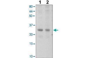 The tissue lysates derived from mouse liver (Lane 1), mouse muscle (Lane 2) were immunoprobed by SOCS2 polyclonal antibody  at 1 : 500. (SOCS2 anticorps  (C-Term))