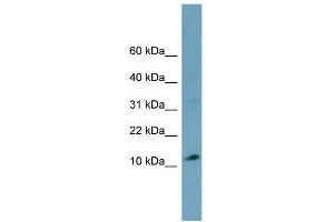 WB Suggested Anti-TRIM36 Antibody Titration:  0. (TRIM36 anticorps  (Middle Region))