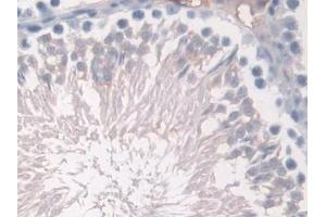 Detection of HBa1 in Mouse Testis Tissue using Polyclonal Antibody to Hemoglobin Alpha 1 (HBa1)