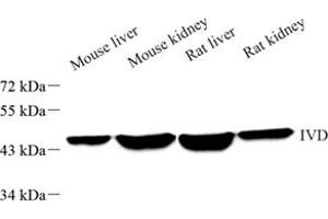 Western blot analysis of IVD (ABIN7074382),at dilution of 1: 2000