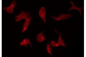 ABIN6275387 staining Hela by IF/ICC. (KCNQ5 anticorps  (C-Term))