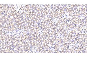 Detection of PRCP in Mouse Kidney Tissue using Polyclonal Antibody to Prolylcarboxypeptidase (PRCP) (PRCP anticorps  (AA 169-443))