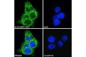 ABIN570702 Immunofluorescence analysis of paraformaldehyde fixed HepG2 cells, permeabilized with 0. (AGXT anticorps  (Internal Region))