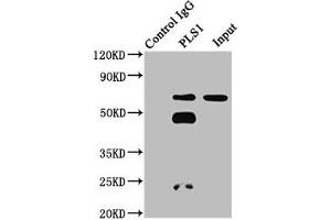 Immunoprecipitating PLS1 in 293 whole cell lysate Lane 1: Rabbit control IgG instead of ABIN7163552 in 293 whole cell lysate.