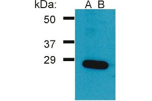 Western Blotting analysis (reducing conditions) of Ramos cell lysateusing two batches of rabbit anti-Grb2 polyclonal (A, B).
