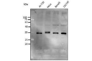 Anti-STUB1 Ab at 1/2,500 dilution, lysates at 50 µg per Iane, rabbit polyclonal to goat lgG (HRP) at 1/10,000 dilution, (STUB1 anticorps)