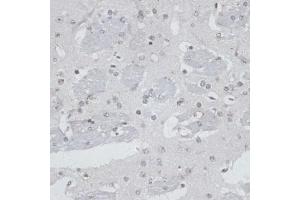 Immunohistochemistry of paraffin-embedded mouse brain using USP7/HAUSP antibody (ABIN6132280, ABIN6150032, ABIN6150034 and ABIN6217614) at dilution of 1:100 (40x lens). (USP7 anticorps  (AA 206-1102))