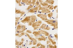 Immunohistochemical analysis of paraffin-embedded H. (AK4 anticorps  (AA 119-153))