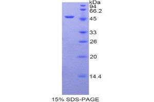 SDS-PAGE (SDS) image for Arrestin, beta 2 (ARRB2) (AA 262-430) protein (His tag,GST tag) (ABIN1877492)