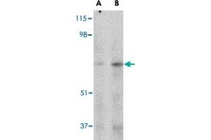 Western blot analysis of MAPKAP1 in human skeletal muscle tissue lysate with MAPKAP1 polyclonal antibody  at (A) 1 and (B) 2 ug/mL .