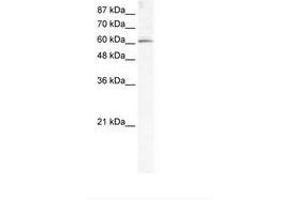 Image no. 1 for anti-Methyltransferase Like 3 (METTL3) (AA 206-255) antibody (ABIN202782) (METTL3 anticorps  (AA 206-255))
