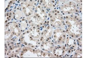 Image no. 12 for anti-Transforming, Acidic Coiled-Coil Containing Protein 3 (TACC3) antibody (ABIN1498097) (TACC3 anticorps)