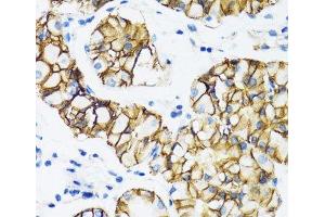 Immunohistochemistry of paraffin-embedded Human stomach using CTNNA1 Polyclonal Antibody at dilution of 1:100 (40x lens).