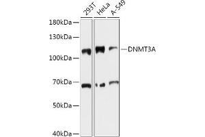 Western blot analysis of extracts of various cell lines, using DNMT3A antibody (ABIN6130284, ABIN6139747, ABIN6139749 and ABIN6215481) at 1:1000 dilution. (DNMT3A anticorps  (AA 500-700))