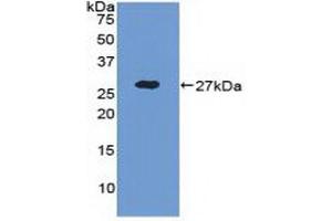 Detection of Recombinant ADAM17, Human using Polyclonal Antibody to A Disintegrin And Metalloprotease 17 (ADAM17) (ADAM17 anticorps  (AA 226-473))